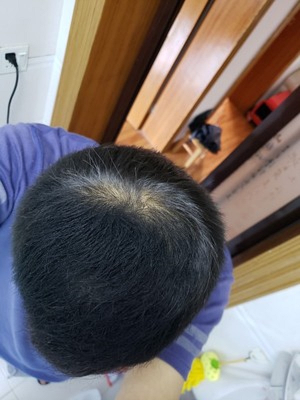 灰暗的人生不想再回忆