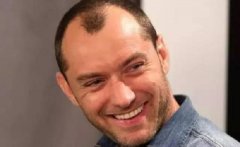 脱发3年以上头发还能长回来吗