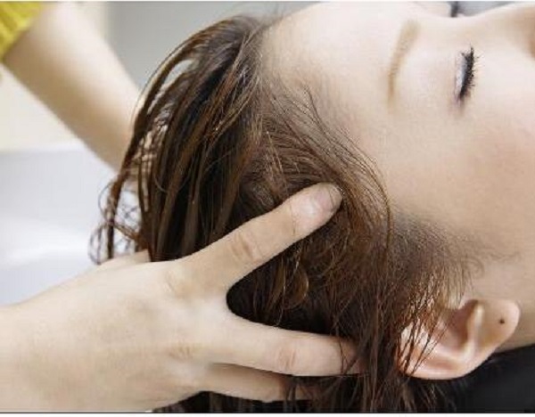 女性脂溢性脱发应该要怎么治疗