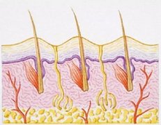 为什么植发一定要用自己的毛囊