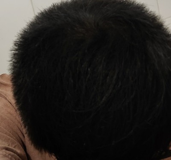 不英俊的外表也想要浓密的头发