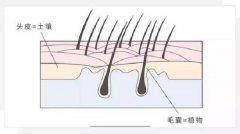 怎么才能判断毛囊是坏死了