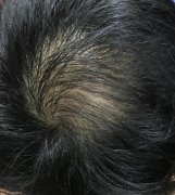 最大的幸运就是遇见了增发纤维