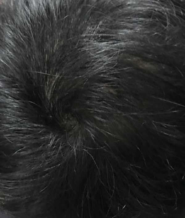 最大的幸运就是遇见了增发纤维