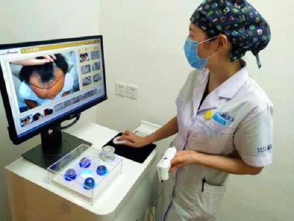 植发手术的成功率高不高