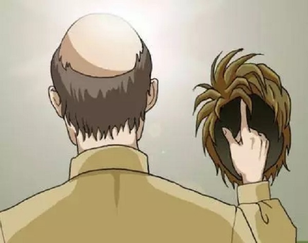 植发需要满足什么条件