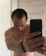 头发稀疏的问题增发纤维来解决