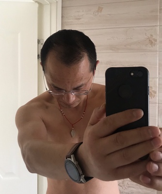 头发稀疏的问题增发纤维来解决