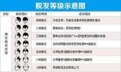 脱发的等级划分