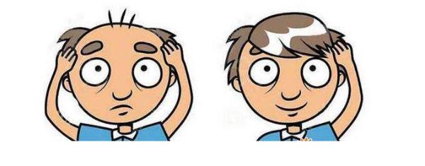 植发手术前后需要注意的事项