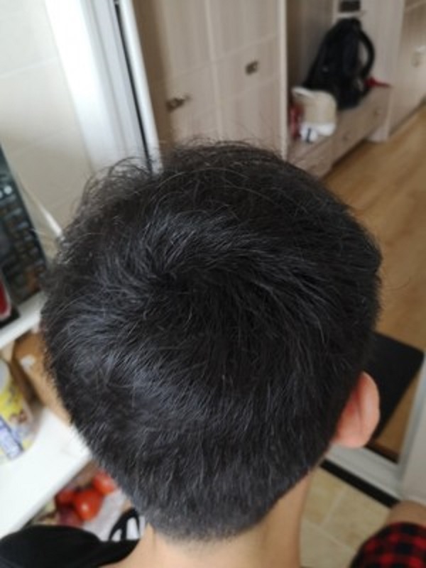 最佳的应急神器：增发纤维