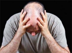 病理性脱发应该要怎么治疗