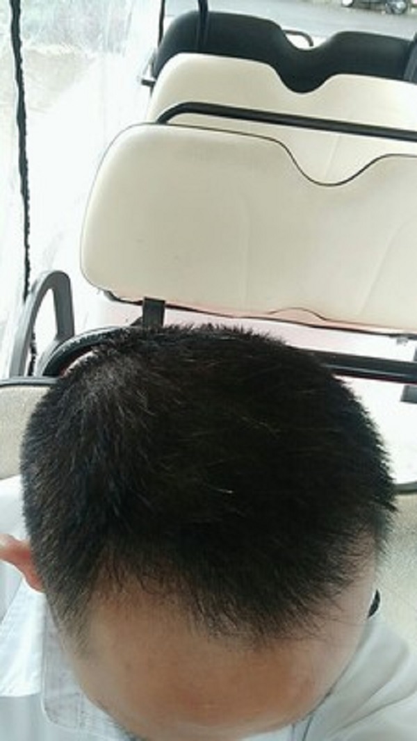 多亏增发纤维，让我重获形象