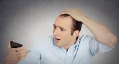 食盐过多真的会导致脱发吗