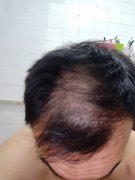 想要改变的我终于遇到了增发纤维