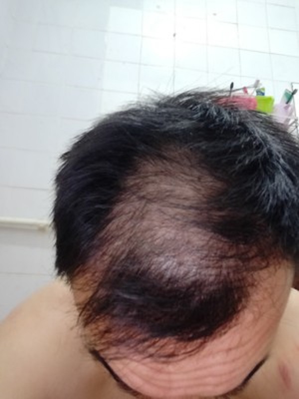 想要改变的我终于遇到了增发纤维