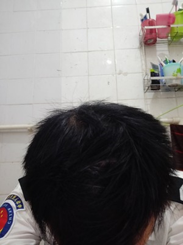 想要改变的我终于遇到了增发纤维