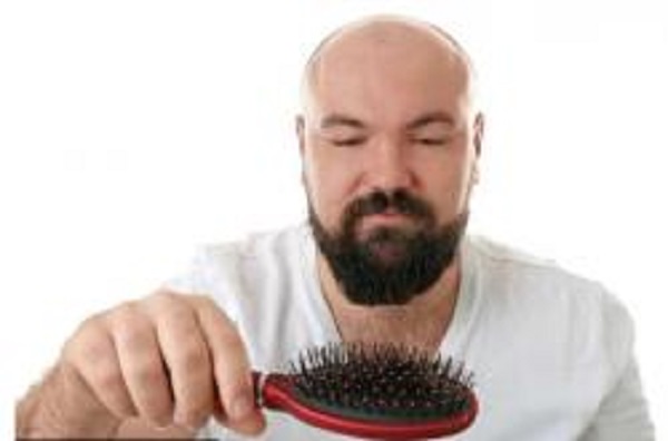 男性脱发一般是从什么年纪开始的