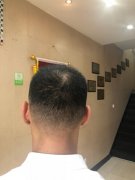 本来没有什么希望，但是我却遇到了增发纤维