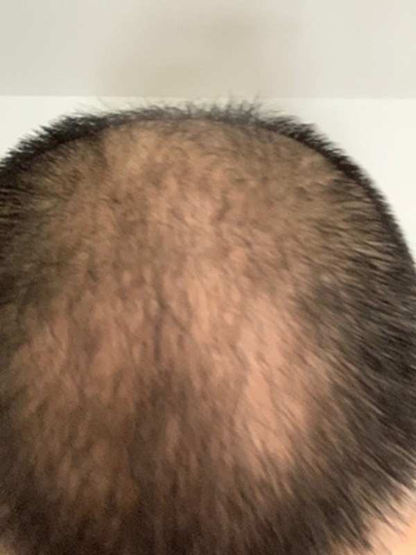 因为有了增发纤维，我终于不是单身狗了