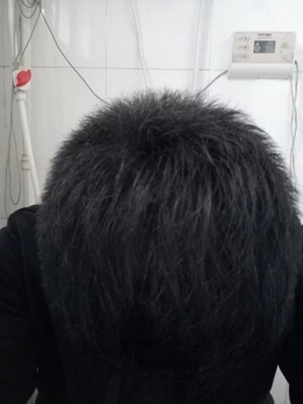 挽救形象的关键，增发纤维