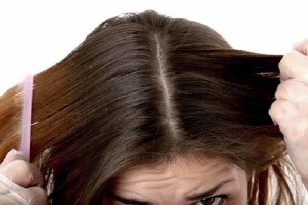 中年妇女掉头发应该要怎么办