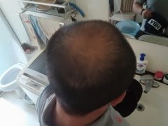 改变形象的关键，增发纤维