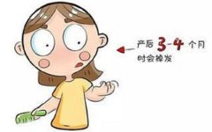 脱发患者应该要注意什么