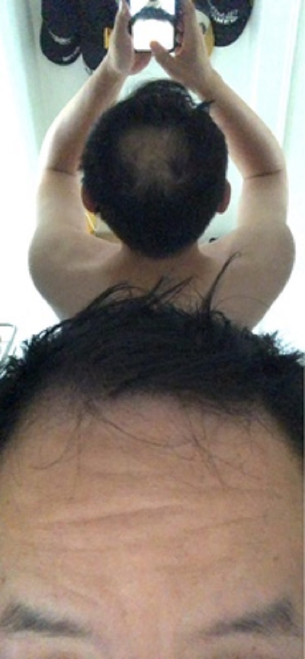 因为头发少导致的形象问题，终于被增发纤维解决了