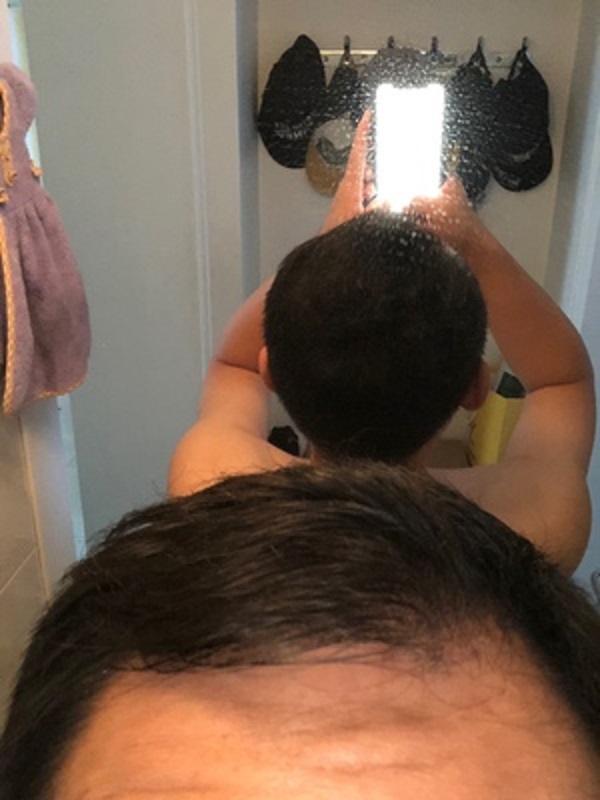 因为头发少导致的形象问题，终于被增发纤维解决了