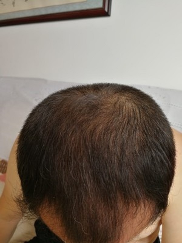 增发纤维拯救了脱发的我