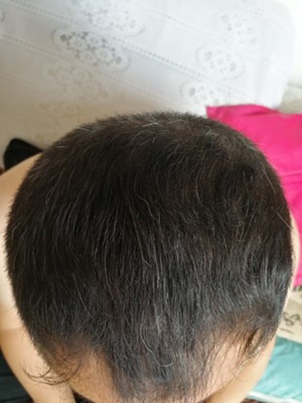 增发纤维拯救了脱发的我