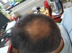 心灰意冷的时候幸运的遇上了增发纤维