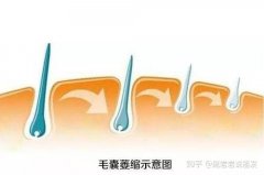 植发后多久可以洗头