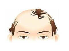 防脱发的小妙招