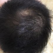 终于找到了增发纤维神器