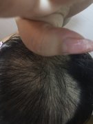 增发纤维让我摆脱了脱发的阴影