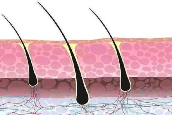 植发后还会不会脱发呢