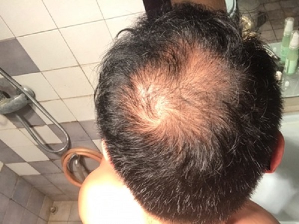 感谢增发纤维改变了我的形象