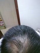 增发纤维成功的挽救了我的形象