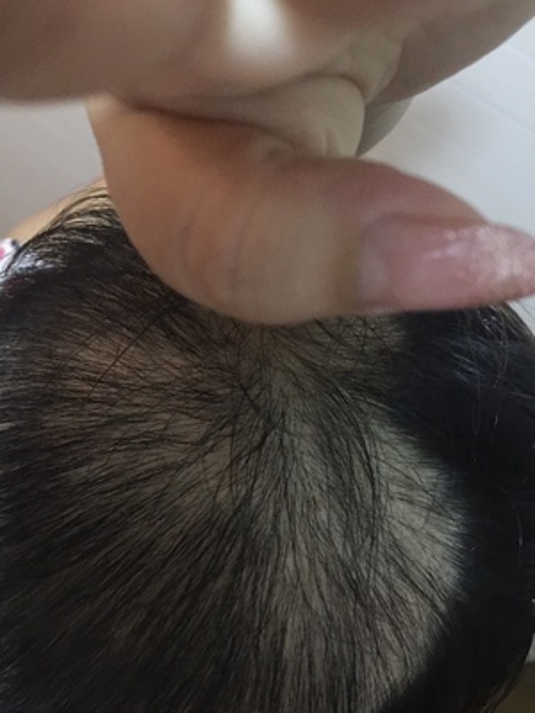 增发纤维真的是我的救星啊