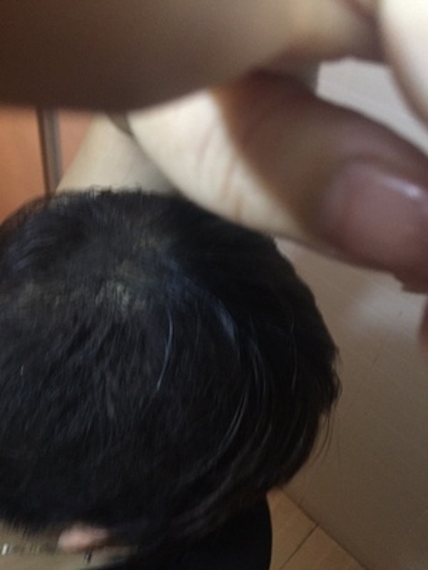 增发纤维真的是我的救星啊