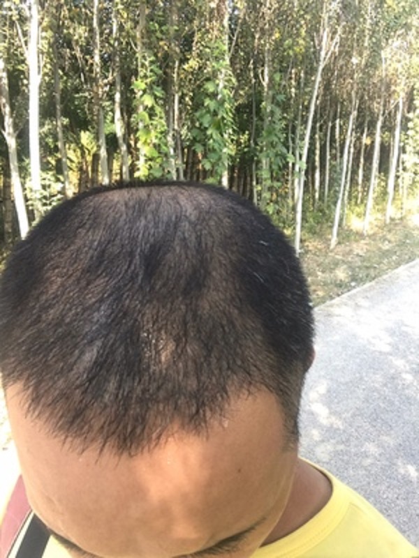 不甘心的我终于遇到了增发纤维