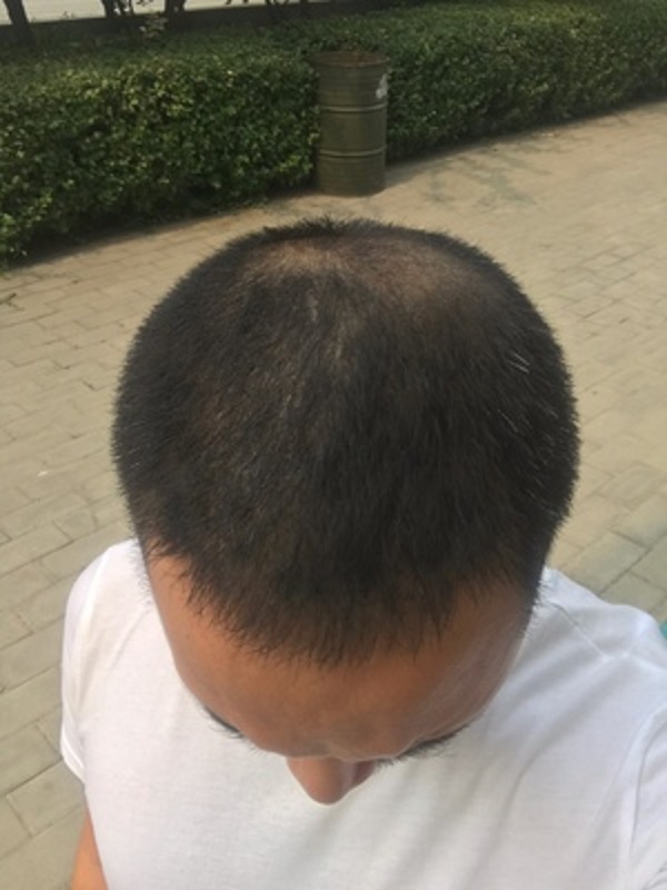 不甘心的我终于遇到了增发纤维