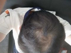 增发纤维是我重塑自信的勇气