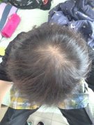 多亏增发纤维恢复了我的形象