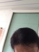 增发纤维成功挽救了我的形象