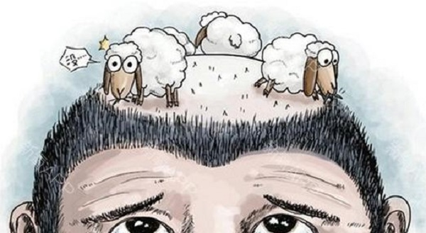 植发的毛囊为什么不能用别人的