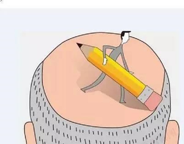 怎么判断自己是否适合植发