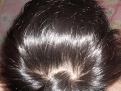 每天掉头发怎么办